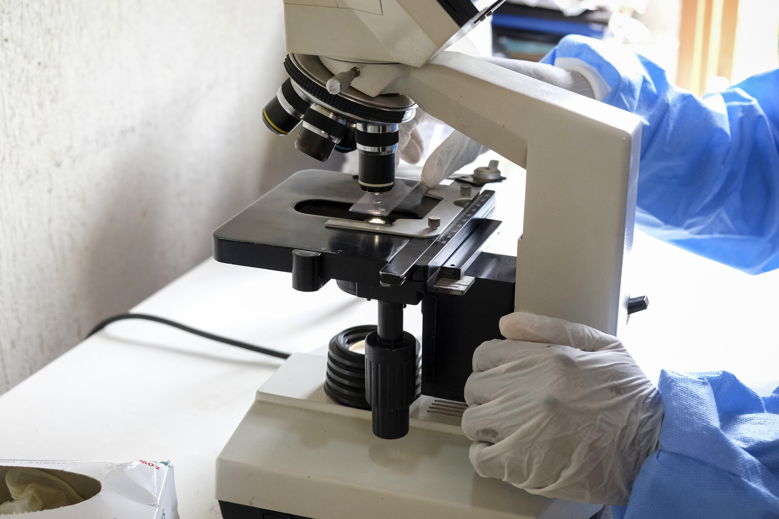 ebola resultat negatif au test effectue sur un patient rentre en sardaigne en provenance du congo scaled
